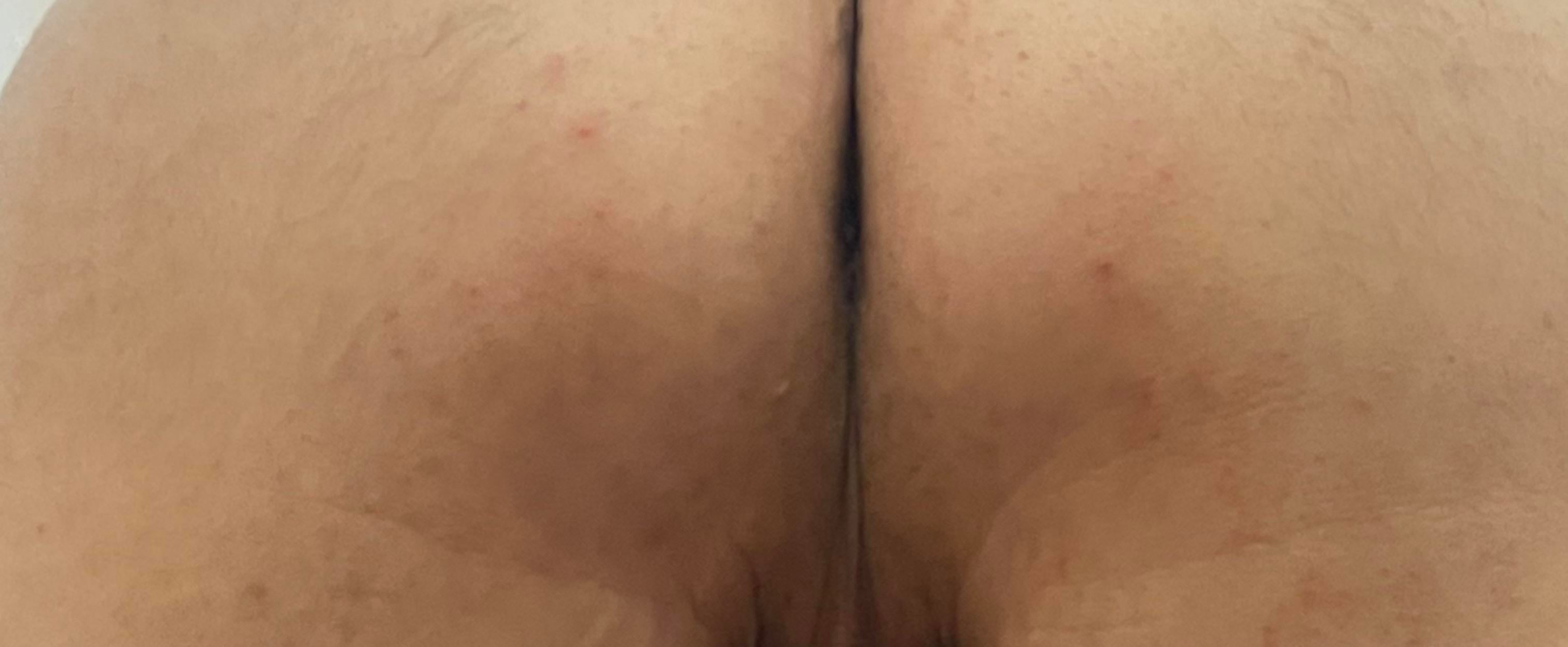 Post image preview