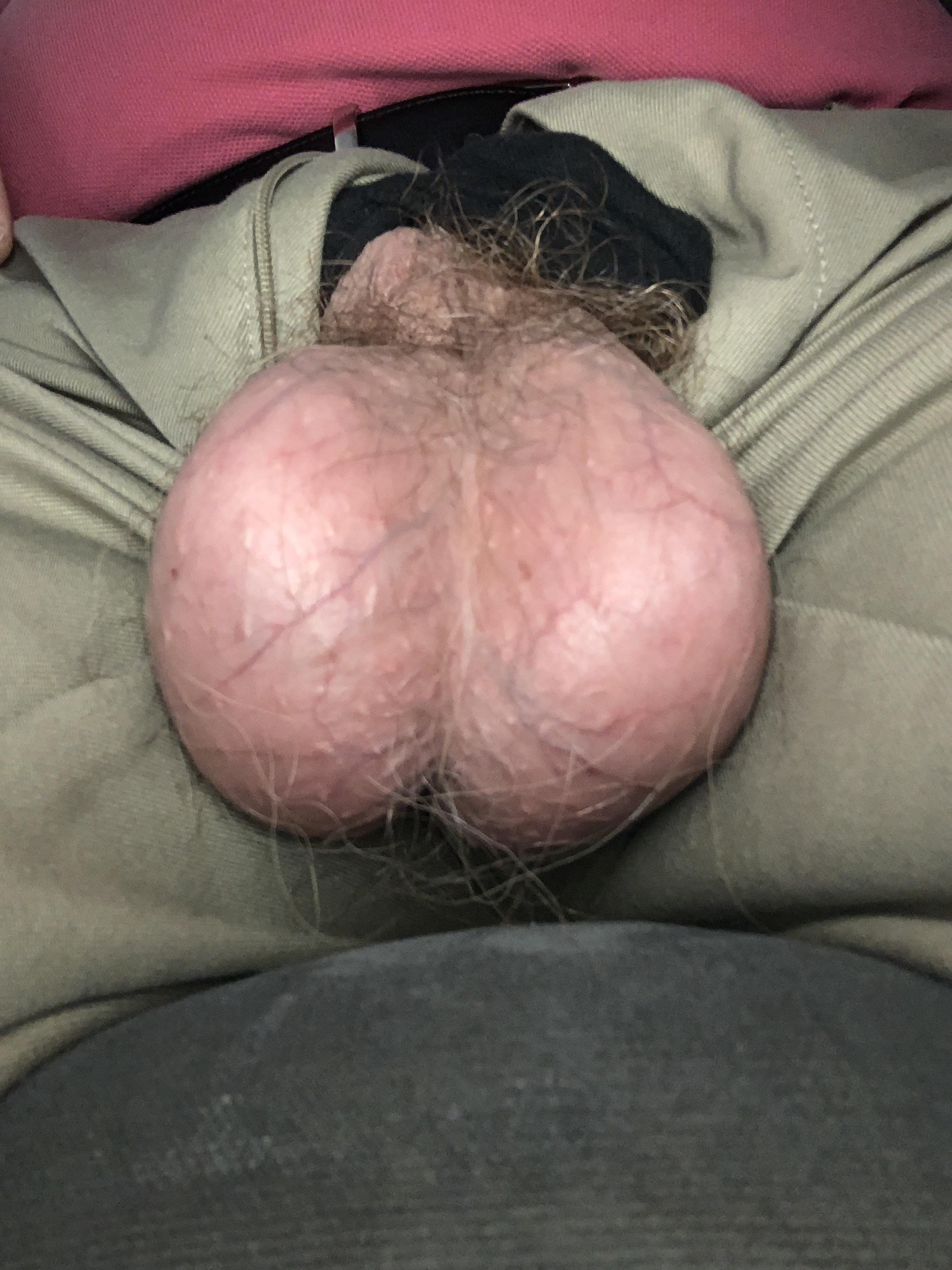 Post image preview