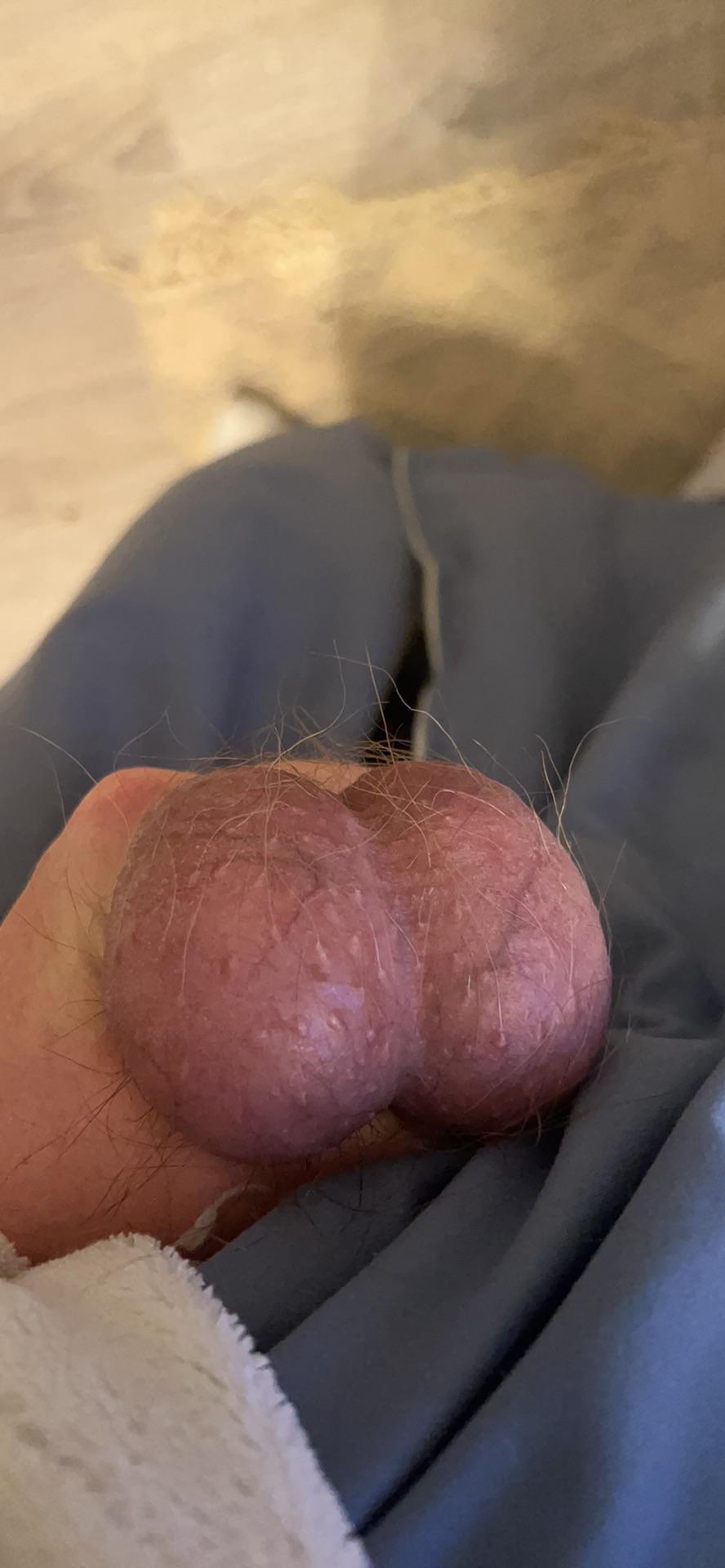 Post image preview